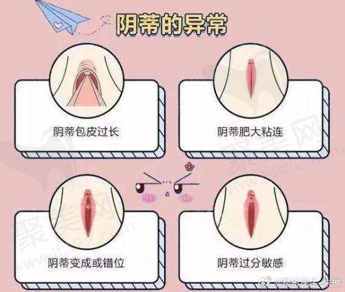 一、广州建国医院私密整形科正规吗？
