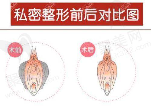 三、广州建国医院私密整形科诊疗项目有哪些？