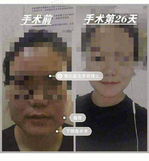 二、吴一医生擅长项目