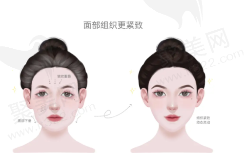 南宁华美医疗美容医院杨明医生预约方式