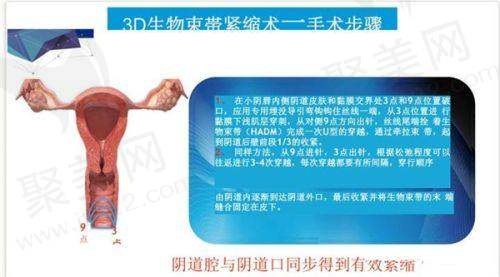 南宁华美医疗美容医院杨明医生擅长项目