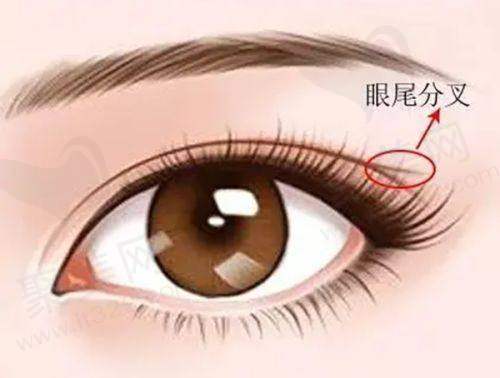 缩阴选激光还是手术好？创伤和修复情况大不同