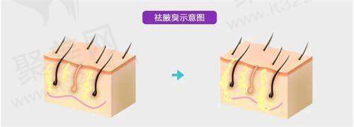不同来源给出的哈尔滨埋线减肥价格参考