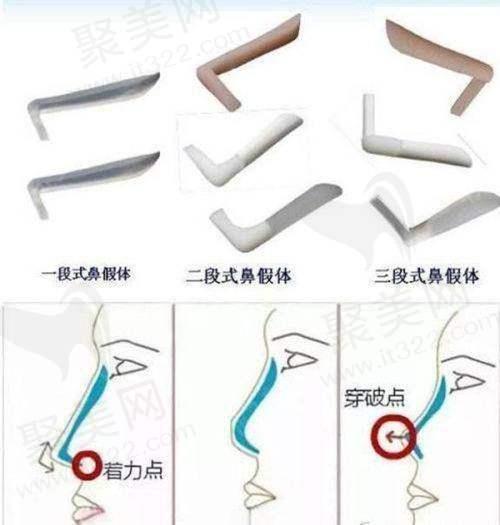 合肥东方怡人医疗美容诊所许飞医生的口碑评价