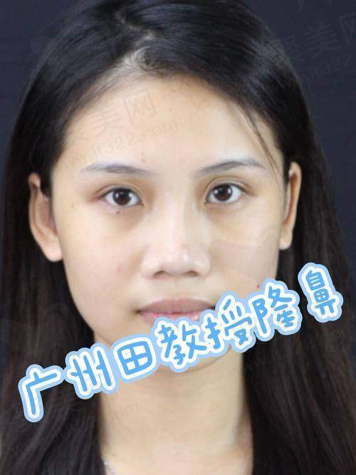 四、连凯峰医生与其他医生对比优势
