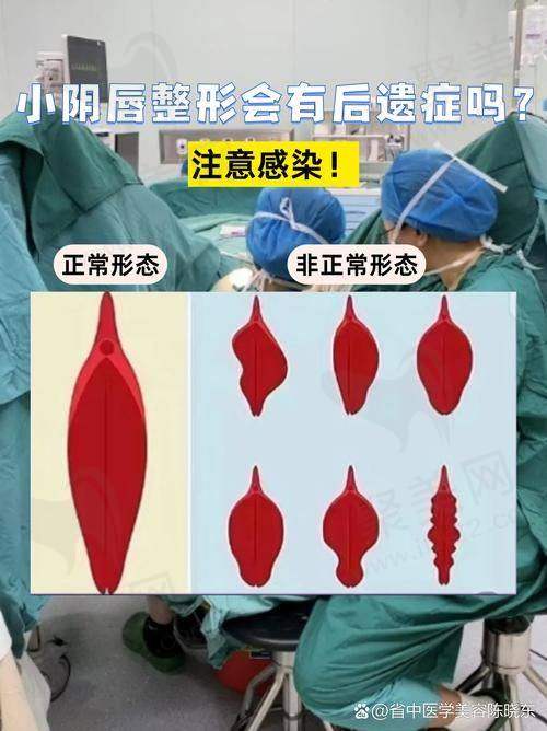 深圳阳光整形医院处女膜修复的作用和意义