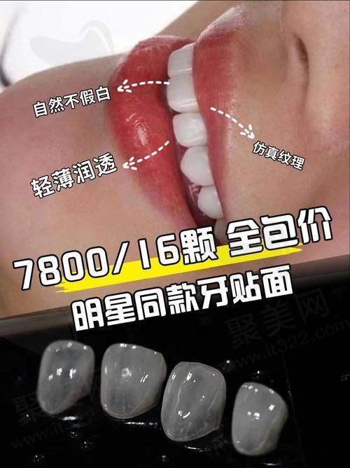 深圳友睦口腔E-max铸瓷牙齿贴面美白的作用