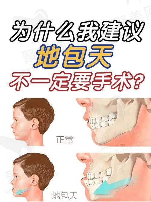 地包天矫正费用与最佳年龄揭秘，了解地包天形成原因及矫正医院推荐