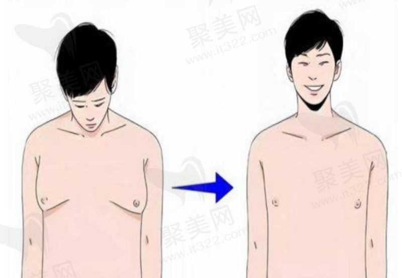 缩阴选激光还是手术好？术前术后的注意事项