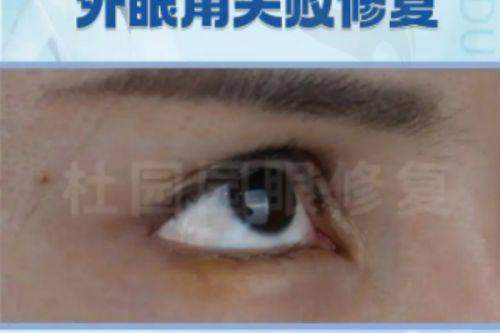 佛山曙光金子医学美容医院李方文医生资质信息
