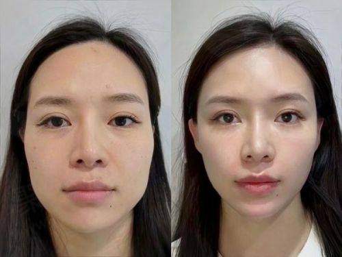 四、我的手术体验与术后成效