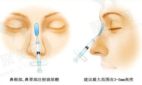 袁继龙医生特色技术优势