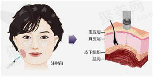 九、唐山华中医疗美容门诊部真实的患者评价