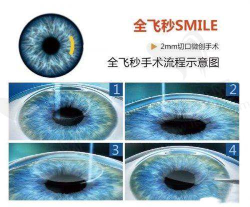 上海新视界眼科医院