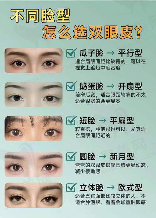 上海马娟双眼皮修复怎么样——真实实例分享