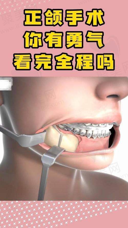 三、王涛医生正颌手术可解决的问题