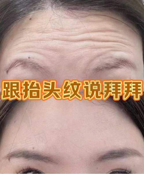七、保持良好的生活习惯