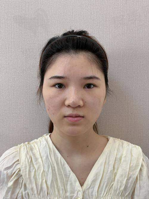 五、选择玻尿酸的风险提示与建议