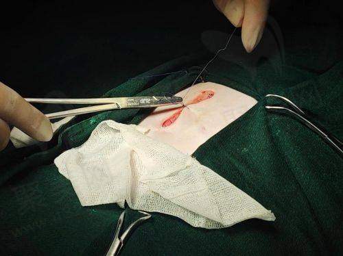 二、广州荔医整形医院医生团队：专精经验多