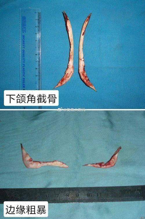 一、吴国平医生简介