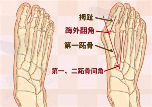 不同人群的需求分析