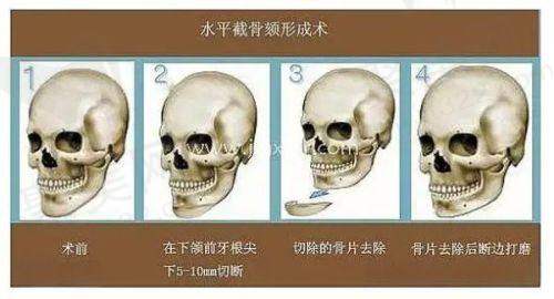 四、武汉美加壹医疗美容医院详细地址与联系方式