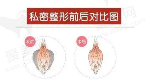 南京鼓楼美莱医疗美容吴志波特色技术优势