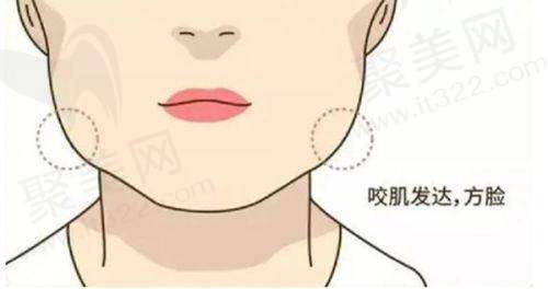 南京鼓楼美莱医疗美容吴志波的口碑评价