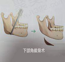 总结