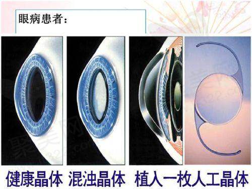 白毒200u的优势