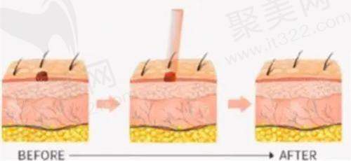 4. 东莞台心医院植发科