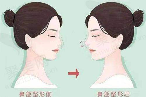 总结