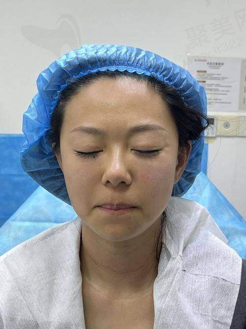 五、消除法令纹的注意事项