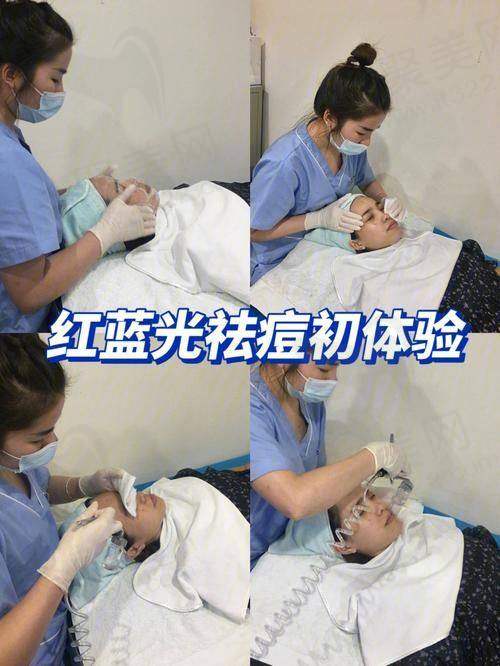 深圳阳光整形医院红蓝光全方面部＋清痘针的技术优势