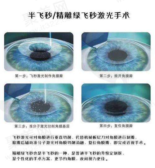沈阳何氏眼科白内障手术做得好吗？医生团队技术优，众多患者术后效果佳获认可 