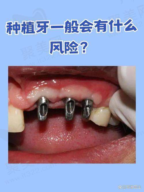 四、芜湖市第一人民医院——孙红医生