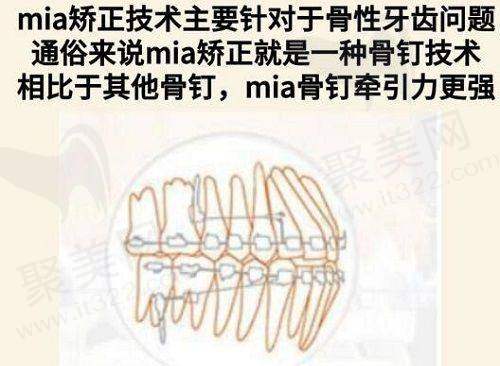 腹部抽脂手术有危险吗？腹部抽脂手术安全吗？深度解析腹部抽脂的副作用与生命风险