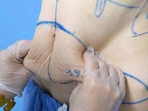 瘦腿方法3天练成筷子腿，瘦腿方法揭秘：掌握这些技巧轻松打造不反弹的筷子腿，轻松实现完美腿型！