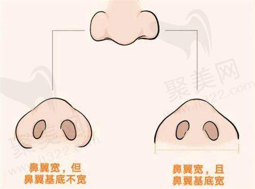 充足睡眠是内脏脂肪消除更快的方法