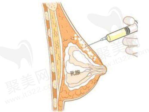 怎么样才能瘦肚子更快更有效？瘦肚子最快最有效的方法，7个运动与饮品助你轻松减掉大肚子，健康生活从这里开始！