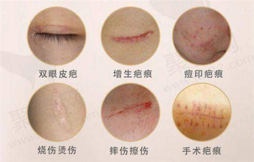 卢九宁人中缩短术价格揭秘，真实口碑与效果分析，值得选择的整形项目
