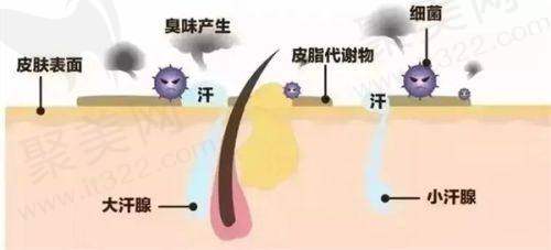 卢九宁人中缩短术适合人群分析
