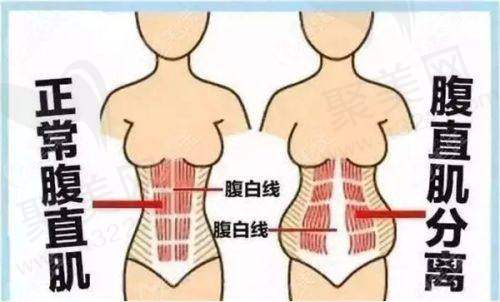 5 怎么样才能瘦肚子更快更有效？按摩瘦腹！
