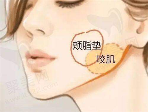 卢九宁人中缩短术真实口碑评价