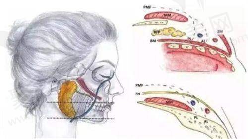 轻薄针和溶脂针的基本概念