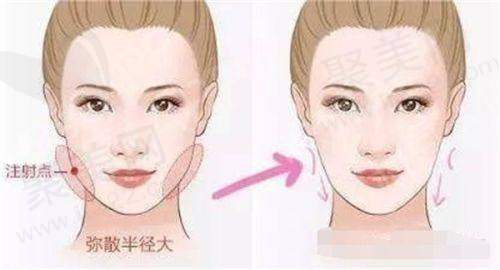 牙齿矫正对修复脸部凹陷的影响