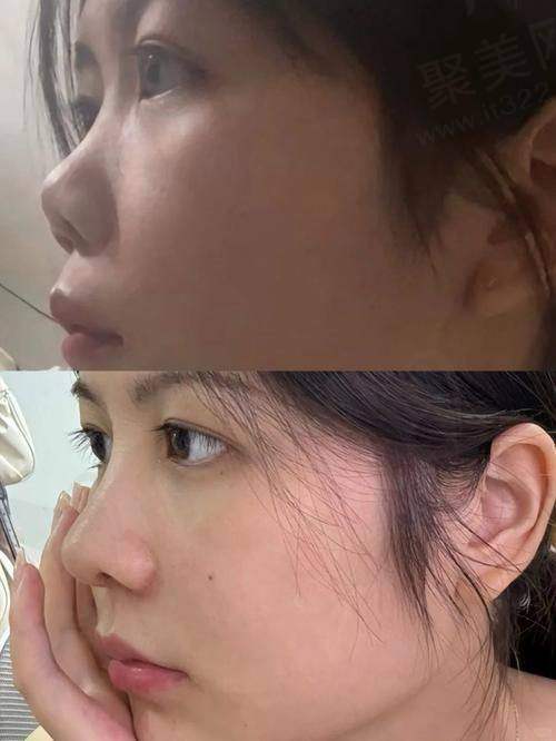 成都艺星周顺波医生有哪些丰富的经验优势？