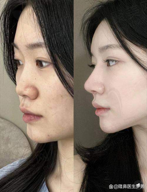 成都艺星周顺波医生的手术技术优势是什么？
