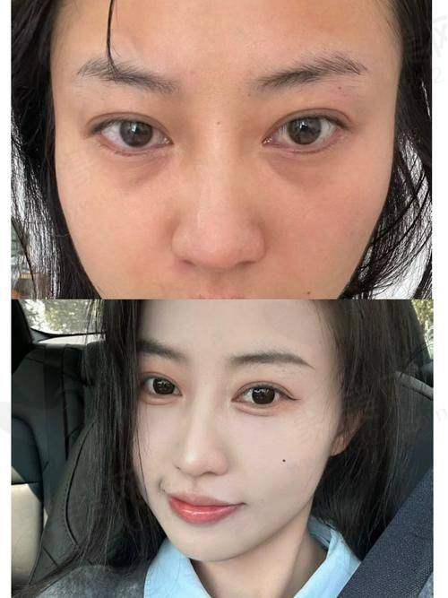 上海首尔丽格医院收费标准参考