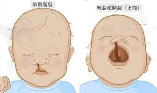 北京马群医生的口碑如何？